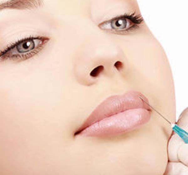 Perfilado de Labios
