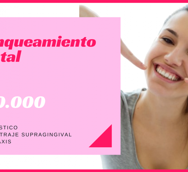 blanqueamiento-dental-led