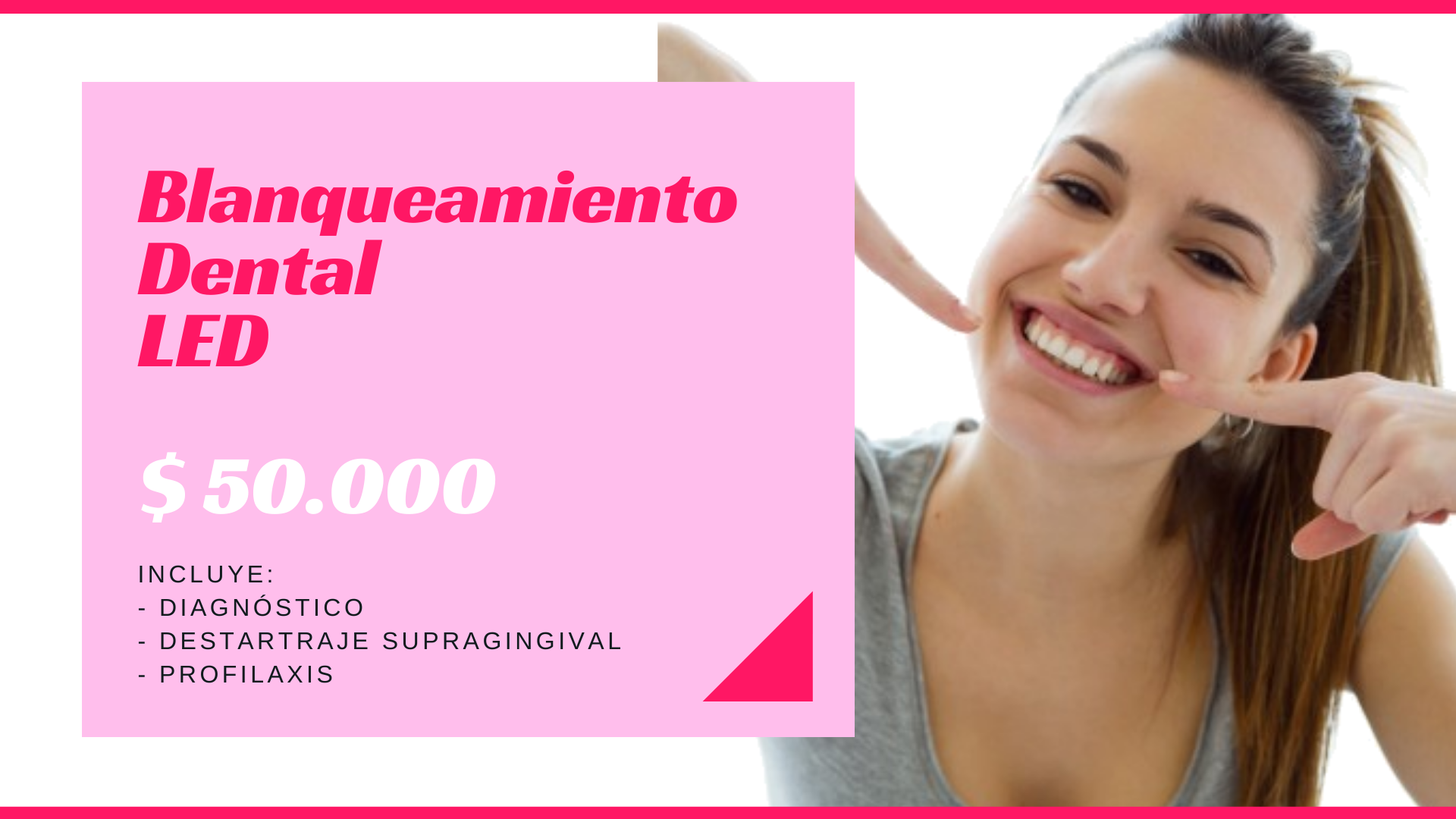 Promoción Blanqueamiento Dental LED